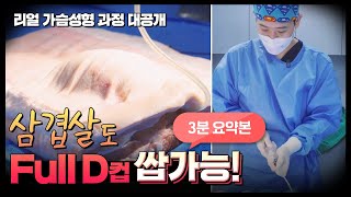 가슴성형 과정 3분 만에 직접 보여dream~!(feat. 삼겹살)