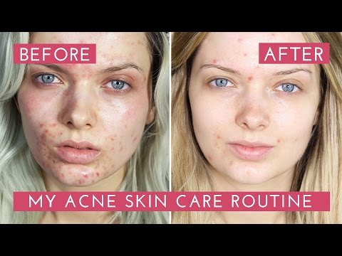 download lagu mp3 mp4 Apicare Repair Me, download lagu Apicare Repair Me gratis, unduh video klip Apicare Repair Me