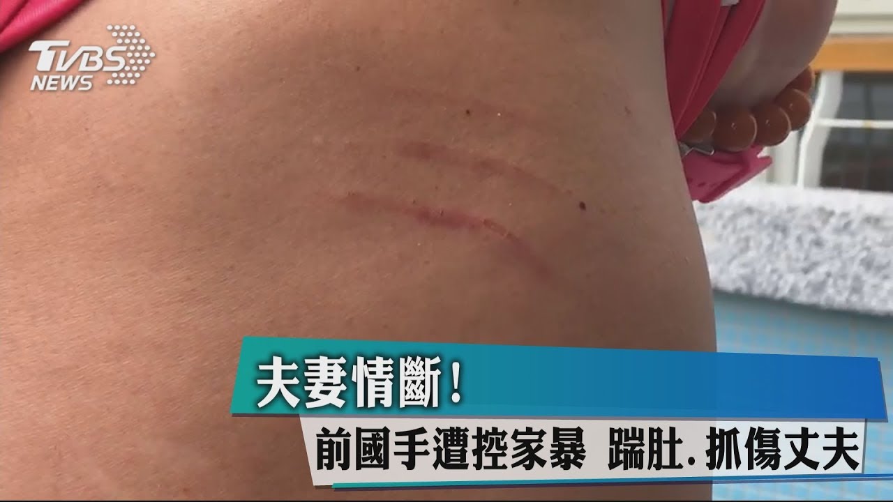 夫妻情斷!前國手遭控家暴 踹肚、抓傷丈夫