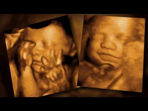 3rd YouTube video about how to prepare for a 3d ultrasound