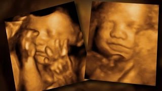 FDA warns against 3-D "keepsake" ultrasounds
