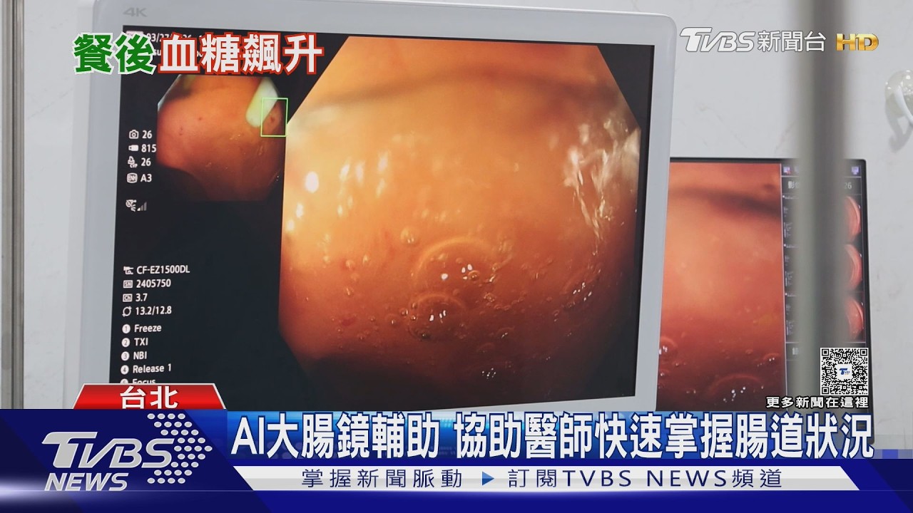 飯後「1動作」血糖秒降!醫曝黃金時間 深蹲這樣做最有效