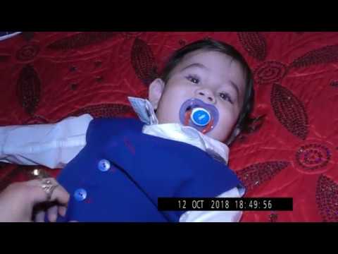 1 cas rd DENIZ-filyo