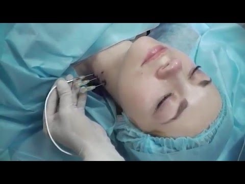 Боль в шее в пост Топография костей и суставов
