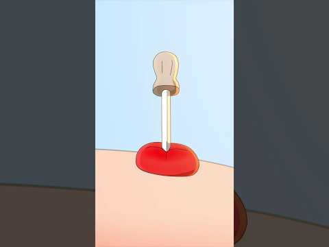 How to cure mosquito bite marks perfectly!