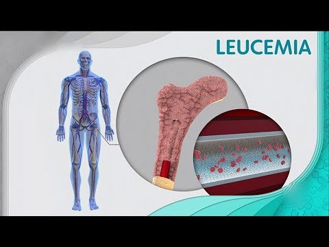 Bem Estar - 01/11/2018 Câncer De Intestino l Leucemia Mieloide Crônica