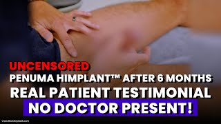 Download lagu AMAZING! 6-Month Honest Penuma Implant Review | Real Patient’s Testimonial Without a Doctor Present mp3 Download lagu AMAZING! 6-Month Honest Penuma Implant Review | Real Patient’s Testimonial Without a Doctor Present mp3