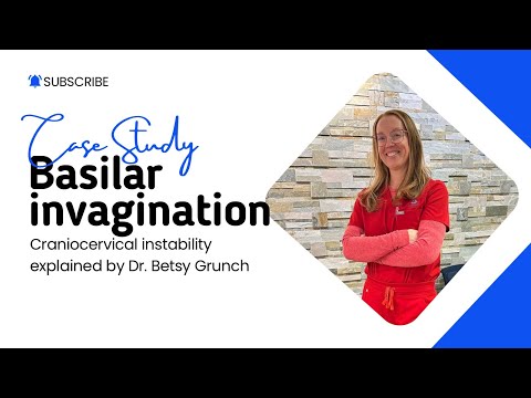 Case study 151 | Basilar invagination | Craniocervical instability explained by Dr. Betsy Grunch