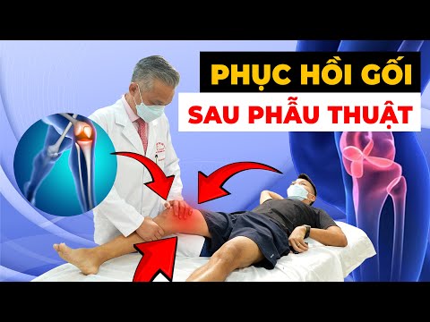 Sau Phẫu Thuật Khớp Gối, Bạn Còn Đau? Cách Phục Hồi Hiệu Quả! |