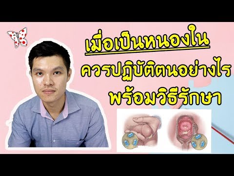 ชายอ่อนแอสาเหตุทางจิตวิทยา ทำแรงสืบไม่ได้รับผลกระทบ