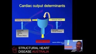 Management of inadequate cardiac output postoperatively – Dr Marek Nalos