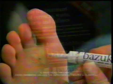 Bazuka Verruca Gel Commercial 1995