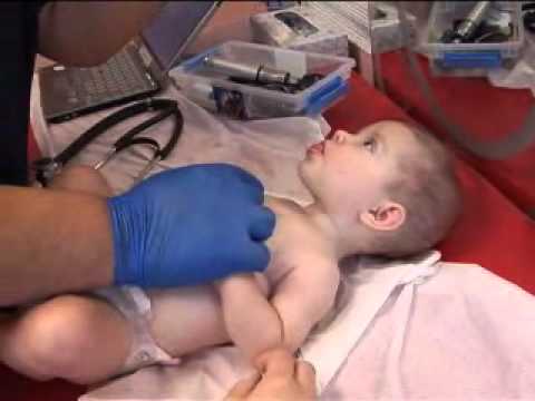 Rotavirus Vaccine: A Game-Changer in Pediatric Health | Vibepedia