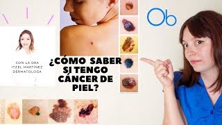 ¿Cómo saber si tengo Cáncer de Piel? con la Dra Itzel Mtz 👩🏼‍⚕️Dermatóloga