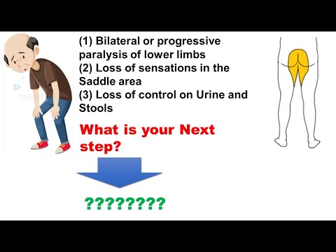 #usmle #internal_medicine #cme #medicaleducation #ecg #كورسات_باطنة #محاضرات_باطنة #medical