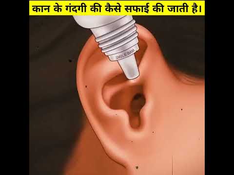 how ear wax is removed? (3D Animation) #shorts​