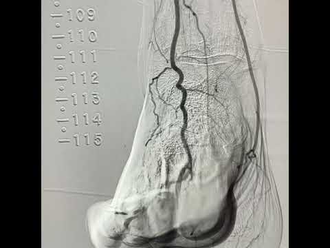 Arteries of the foot and ankle - PrePodiatryClinic101