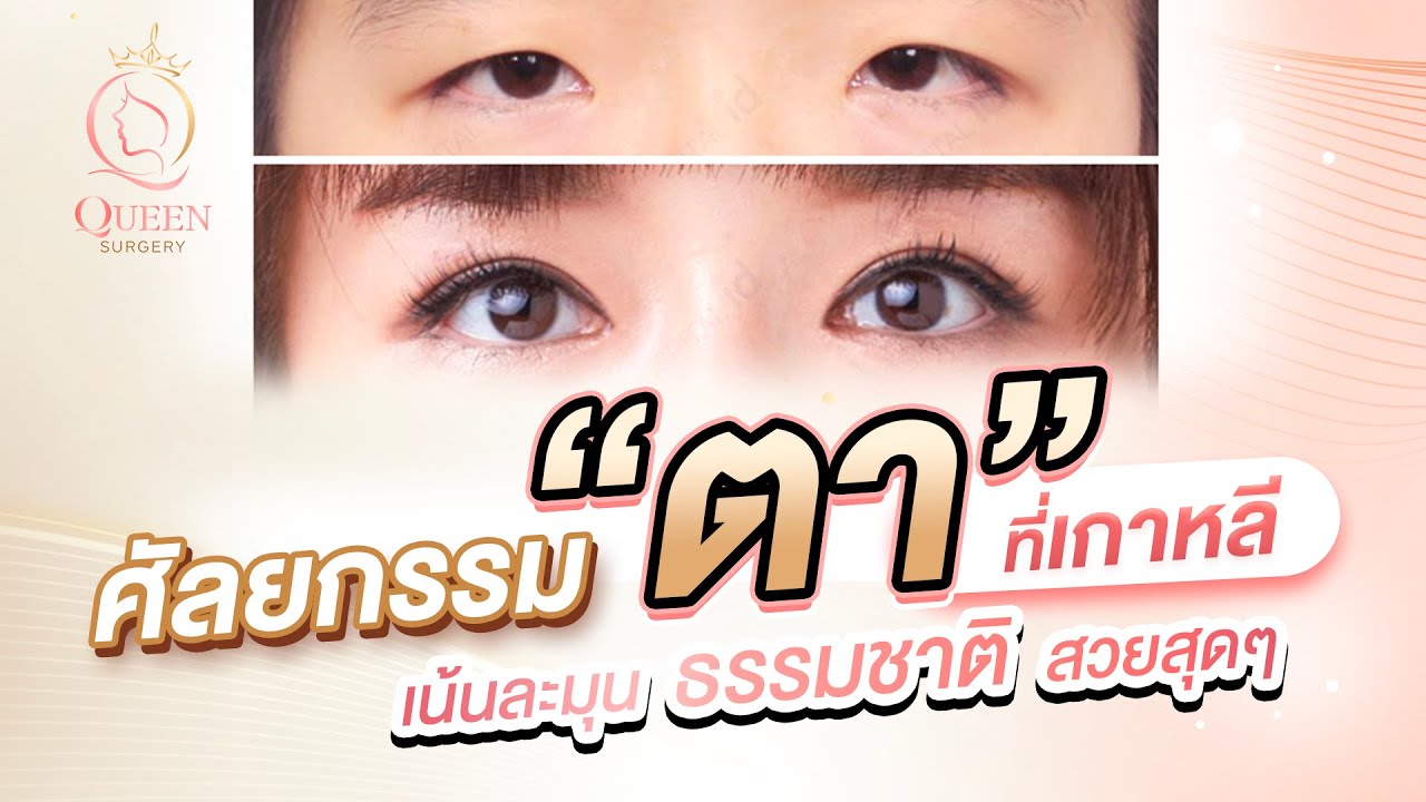 ศัลยกรรมตาเกาหลีเน้นละมุน ธรรมชาติ สวยสุดๆ ฟังจบกลายเป็นผู้เชี่ยวชาญด้านการศัลยกรรมตา👁แน่นอน!!🤣