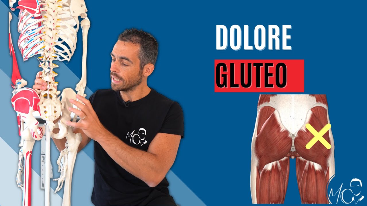 DOLORE GLUTEO / Ecco perchè le VERE CAUSE non vengono mai considerate