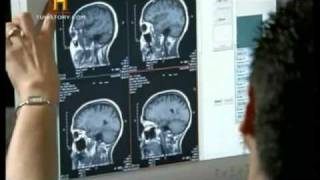 Cerebro Parte 3 Psicopatia, Memoria.mpg - Dr Luis Alberto Montejo