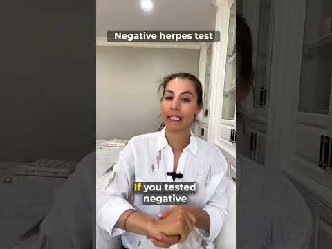 Herpes Test: False Positive