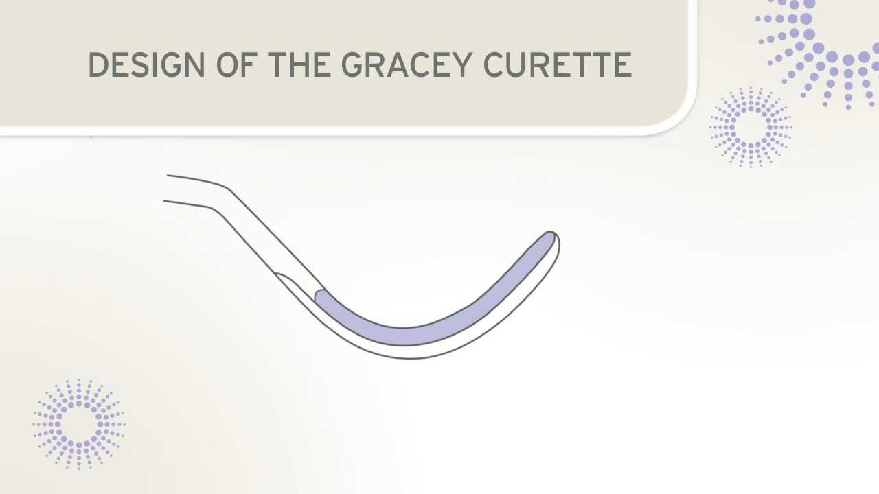 Conception curettes Gracey