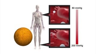 Mars manned mission: How living on Mars would change the human body