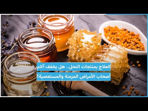 , title : 'العلاج بمنتجات النحل.. هل يخفف آلام أصحاب الأمراض المزمنة والمستعصية؟'