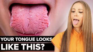 7 Weird Things Your Tongue Is Trying To Tell You