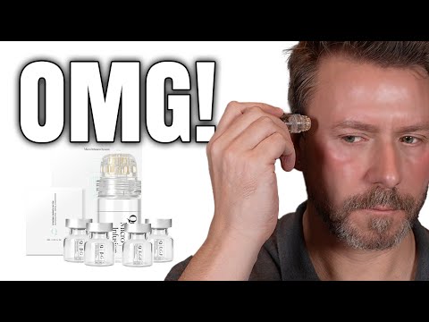 QURE MICRO INFUSION SYSTEM - FACT OR FICTION?!?!