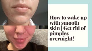 How to wake up with smooth skin | Get rid of pimples overnight!