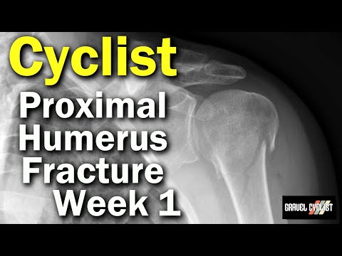 Proximal Humerus Fracture: Cyclist | Part 1