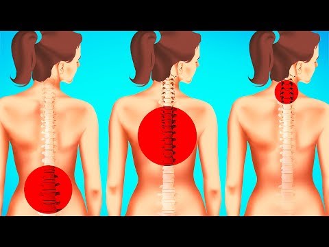 Esercizi video per il mal di schiena Che cura la malattia delle articolazioni delle mani