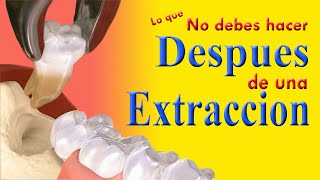 AFTER WISDOM TOOTH EXTRACTION 🦷What to eat and what NOT to do / recovery without infection