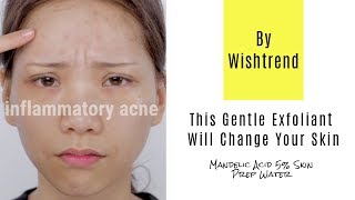This Gentle Exfoliant Will Change Your Skin | By Wishtrend