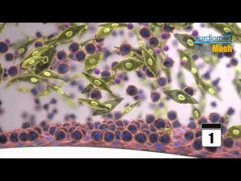 PVDF   PP Comparison