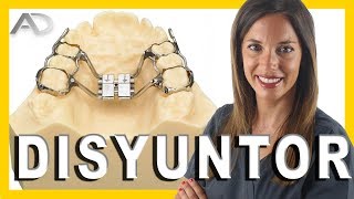 🔷️EXPANSOR DENTAL🔷️ - Disyuntor palatino ortodoncia