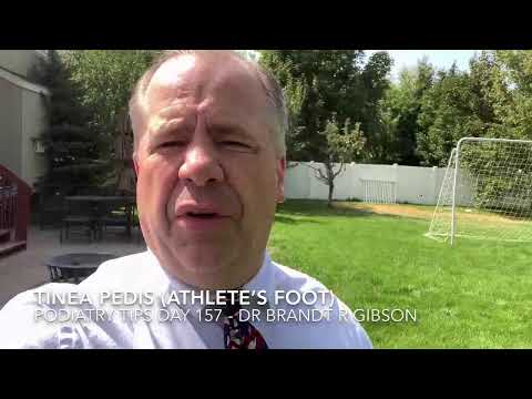 Tinea Pedis (Athlete's Foot)