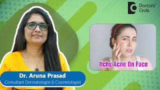 Why Does My Acne Itch So Bad?| Best Remedies For Itchy Acne #pimple -Dr.Aruna Prasad|Doctors