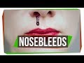 Why Do We Get Nosebleeds