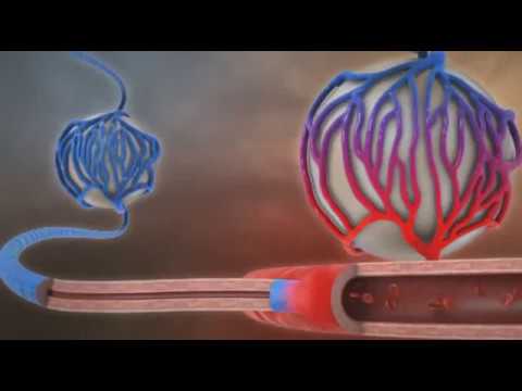Bluthochdruck, Anämie Klassifizierung von pulmonaler arterieller Hypertonie