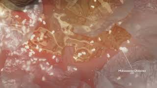  Mechanism Apparition of Dandruff