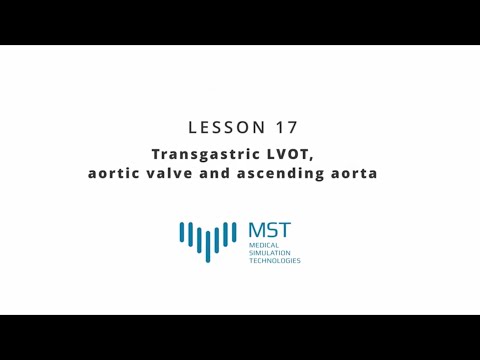 MST Masterclass - Lesson 17 - Transgastric LVOT, aortic valve and ascending aorta