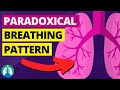Paradoxical Breathing (Medical Definition) | Quick Explainer Video