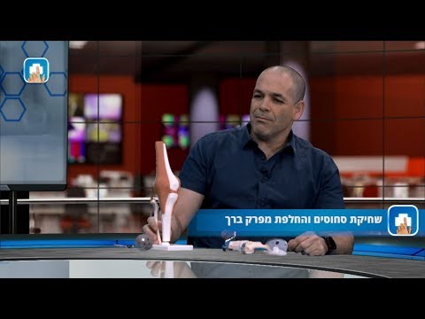 שחיקת סחוסים