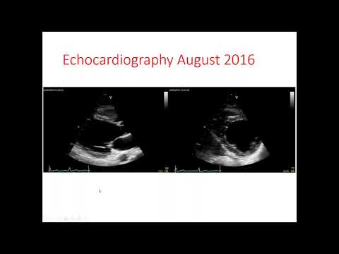 September 2020 ICOS Monthly Case Study Webinar