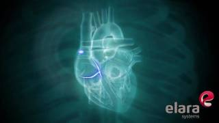 How the Heart Works - Elara Systems