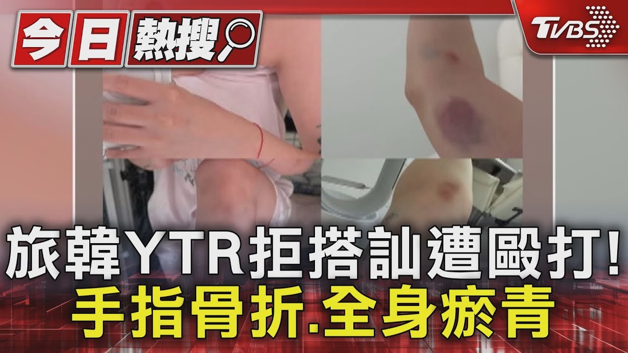 台YTR拒搭訕遭韓男毆打!全身瘀青手指骨折 弘大搭訕施暴非首次