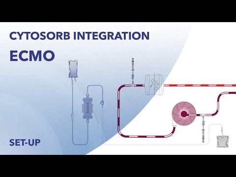 CytoSorb ECMO Integration