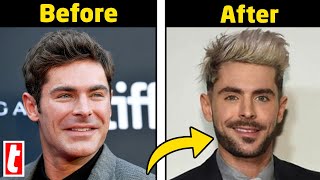 Celebrities Plastic Surgery — Before And After